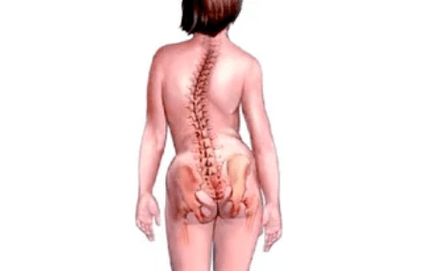 As razões para o desenvolvimento da osteocondrose cervical