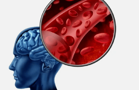 Sintomas de osteocondrose da coluna cervical