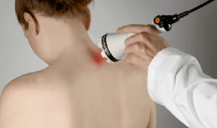 Tratamento da osteocondrose cervical por fisioterapia