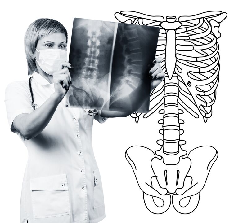 Radiografia da coluna lombar