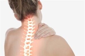 Osteocondrose cervical em uma mulher