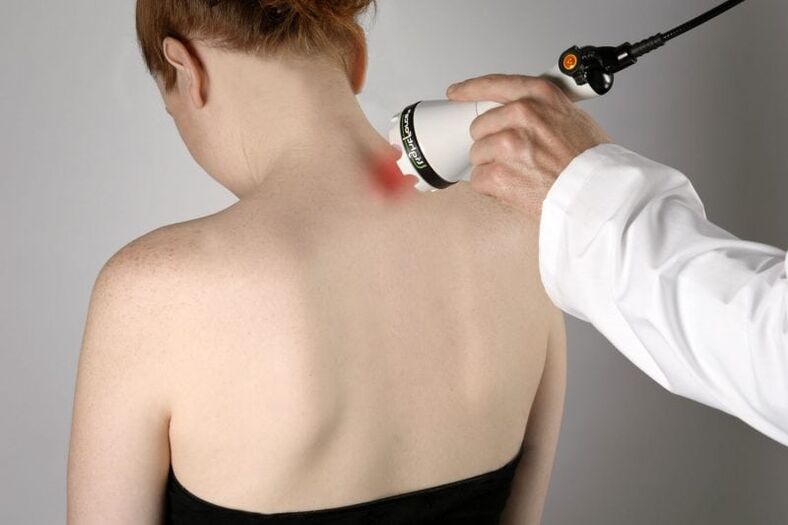 Tratamento da osteocondrose cervical em uma mulher com laser